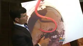 Pool Electrocution Lawsuit WFOR 6-24-14