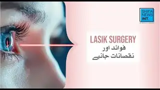 Potential benefits & limitations of LASIK | Shifa News