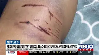 Prichard teacher undergoes surgery nearly a month after dog attack