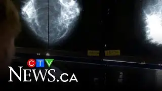 Quebec researchers develop new at-home breast cancer test