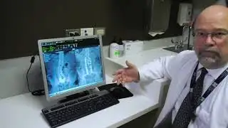 ROBOTIC SPINE SURGERY: FASTER, SAFER, BETTER