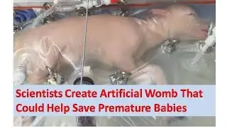Scientists Create Artificial Womb That Could Help Save Premature Babies