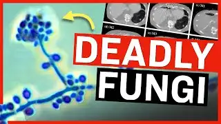 Scientists Warn Deadly Fungi Now Infecting Humans