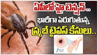 ఏపీలో హై టెన్షన్ ..  భారీగా పెరుగుతున్న స్క్రబ్ టైపస్ కేసులు.. Scrub Typhus Alert in Andhra Pradesh