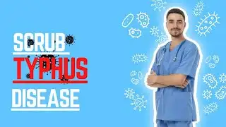 SCRUB TYPHUS ||Definition,  symptoms, Causes, Diagnosis, treatment, Prevention ||