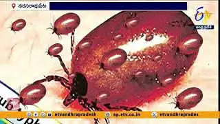స్క్రబ్ టైఫస్ అంటువ్యాధి కాదు | Scrub Typhus Is NOT Contagious | No Need to Panic | Palnadu DMHO