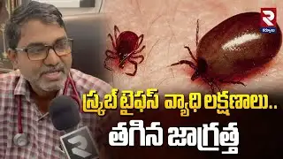 స్క్రబ్ టైఫస్ వ్యాధి లక్షణాలు.. తగిన జాగ్రత్త | Scrub Typhus Symptoms | Scrub Typhus Disease Updates