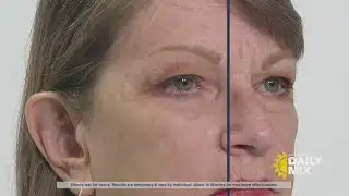 Serum for under-eye bags