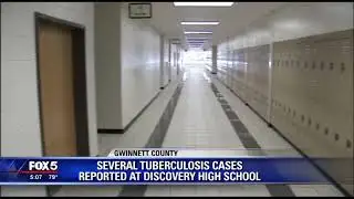 Several TB cases reported at Discovery High School