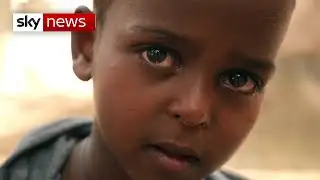 Shot in the head: A human catastrophe unfolds in Ethiopia