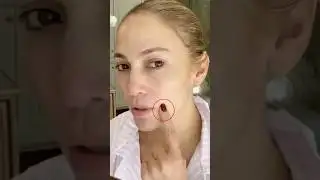 Something Is Definitely Wrong With Jennifer Lopez’s Face