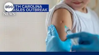 South Carolina measles outbreak spreading rapidly