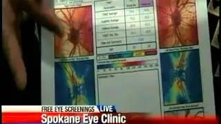 Spokane Doctor Offers Free Glaucoma Screening