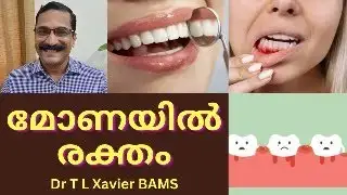 പൊടിക്കൈകൾ || Stop Bleeding Gums Naturally with Ayurveda!