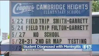 Student Diagnosed With Meningitis In Fair Oaks