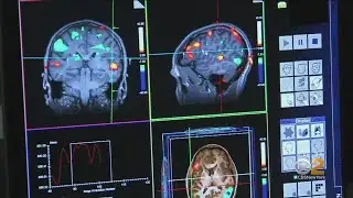 Study Finds Link Between High Blood Pressure, Dementia