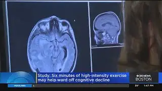 Study: Six minutes of high-intensity exercise may help ward off cognitive decline