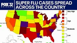 Super flu cases slam U.S.