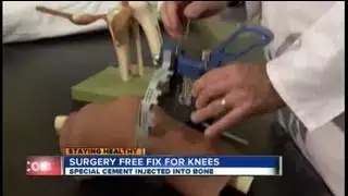 Surgery-free fix for knees