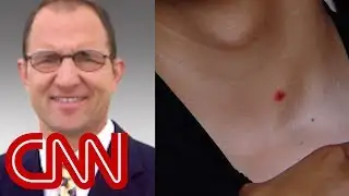 Teacher accidentally fires gun, injures student