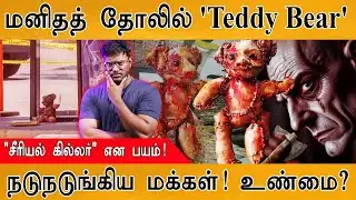 🧸மனிதத் தோலில் 