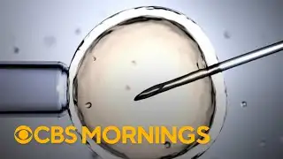 The science and ethics behind genetic embryo screening