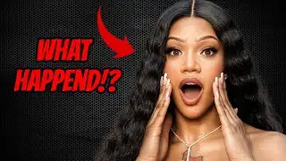 The SHOCKING Truth About GloRilla’s Plastic Surgery