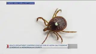 Tick-born illness that causes meat allergy confirmed in West Virginia