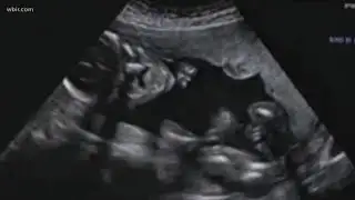 TN lawmakers advance heartbeat abortion bill