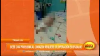 Trujillo: bebé con problema al corazón requiere de operación en EsSalud