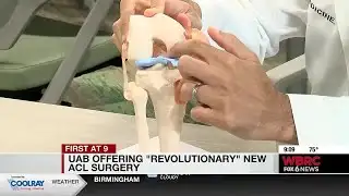 UAB offering "revolutionary" new ACL surgery