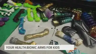 University of Central Florida researchers developing bionic arms for kids
