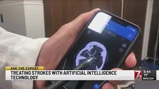 Upstate doctors using artificial intelligence to quickly diagnose and treat strokes