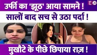Urfi Javed ने ट्रीटमेंट के मुखौटे के पीछे छिपाया असल चेहरा! दुनिया के सामने आया सच! लोग बोले- झूठी!