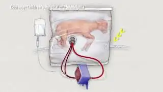 US scientists create artificial womb that could save premature babies
