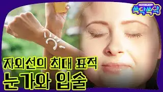 UV rays are the biggest enemies: the eyes and lips.