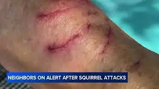 Vicious squirrel sends 2 neighbors to ER after series of attacks