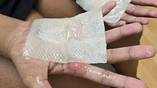 Warren Central High School students burned in punishment at dance practice