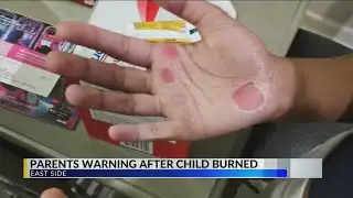 Warren Central student hospitalized with second-degree burns after majorette team practice