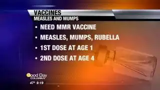 WEDNESDAY: Mumps Outbreak - Your Questions Answered