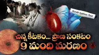 స్క్రబ్ టైఫస్ వ్యాధి ఏమిటి? | What is Scrub Typhus Disease? Which Insect Causes It? | idisangathi