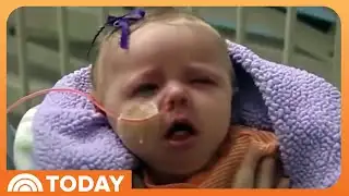 Whooping cough cases surge as vaccination rates continue to drop