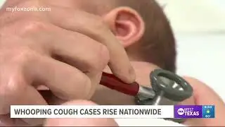 Whooping cough cases surge in US, doctors urge vaccination