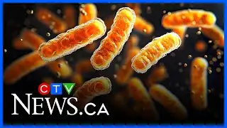 Whooping cough concerns