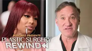 Why Terry Dubrow Says Black Market BBLs Can Be TOO Risky to Reverse | Plastic Surgery Rewind | E!