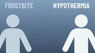 Wind chill explained! Why cold feels colder on windy days