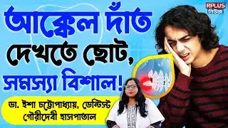আক্কেল দাঁত দেখতে ছোট, সমস্যা বিশাল | Wisdom Tooth Pain | akal daant | R Plus News