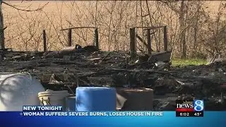 Woman severely burned in house fire