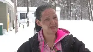 Woman warns others about mistake that left her badly burned