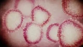 XBB.1.5 COVID-19 subvariant: 4 Fast Facts